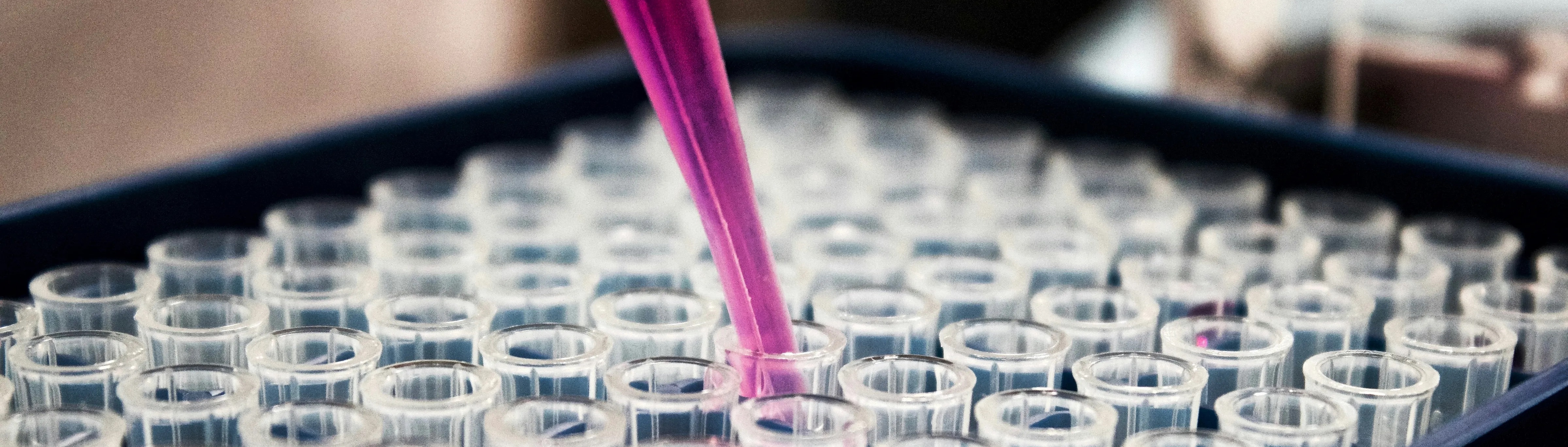 Foto Identificacion Gasto